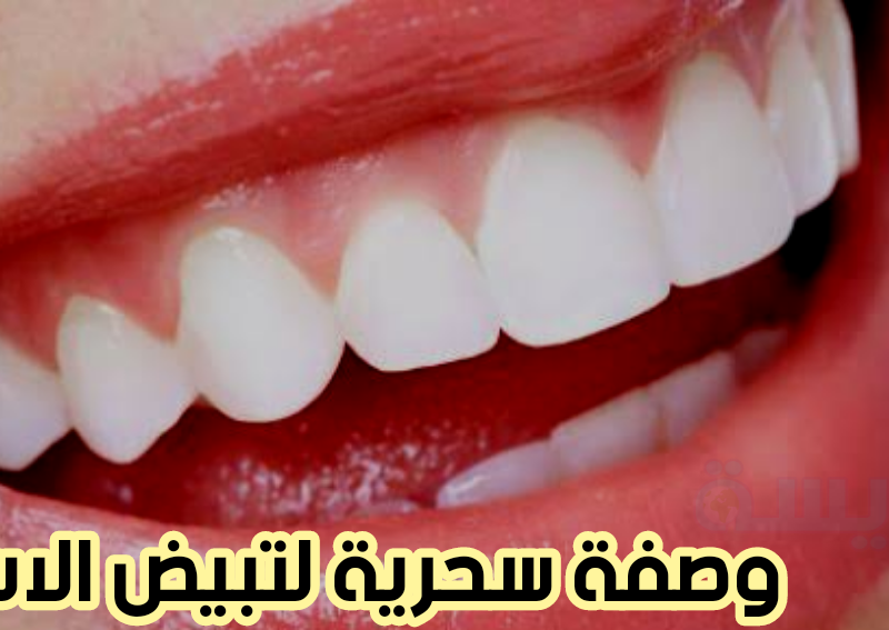 وصفة سحرية لتبيض الاسنان في 5 دقائق وإزالة الطبقة الجيرية
